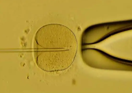 2024国内借卵子助孕费用一览在国外用他人卵子做试管多少钱