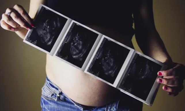 乌克兰三代试管助孕孩子医院排名