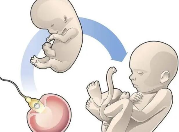 试管婴儿化了是什么意思试管婴儿化胚胎的原因和解决方法